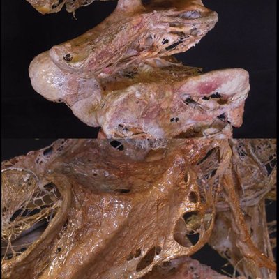 Détail