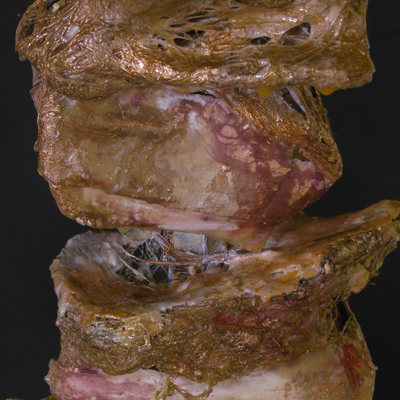 Détail